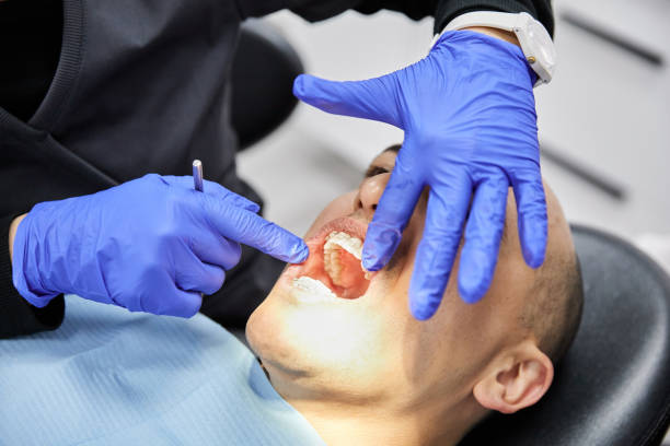 Best Emergency Tooth Extraction in Timonium, MD