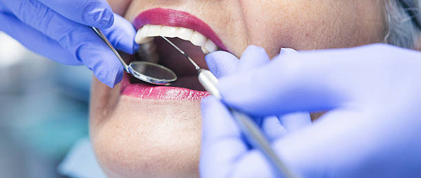 Best Emergency Gum Treatment in Timonium, MD
